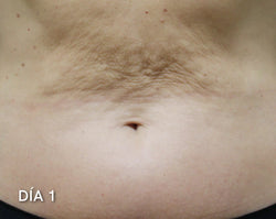 Abdomen