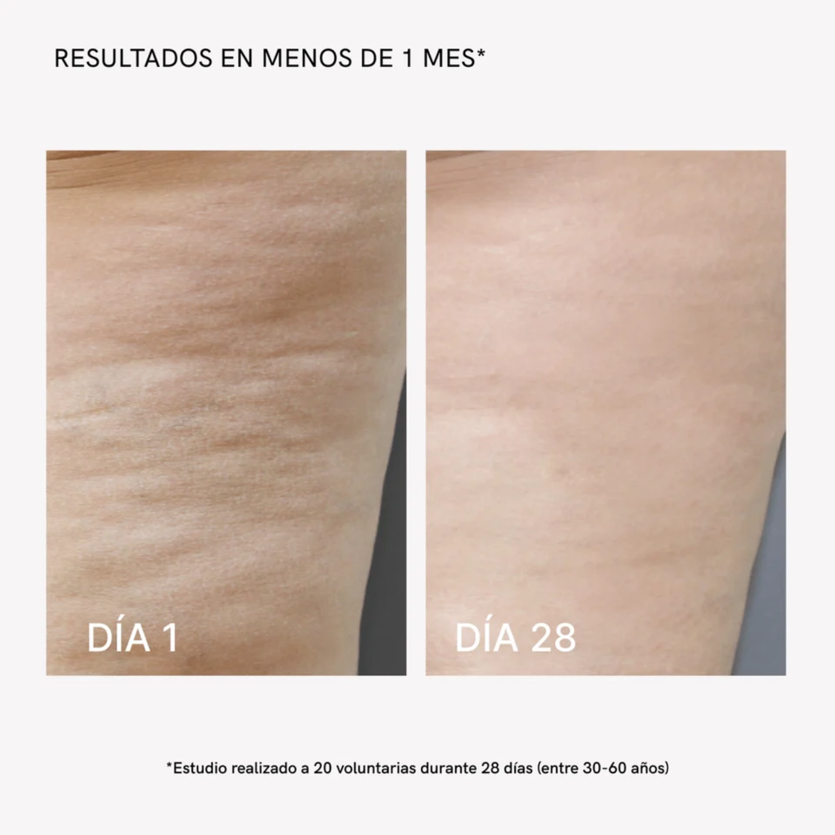 Dispositivo Corporal RF PRO