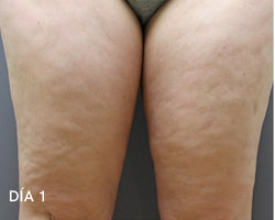 Piernas